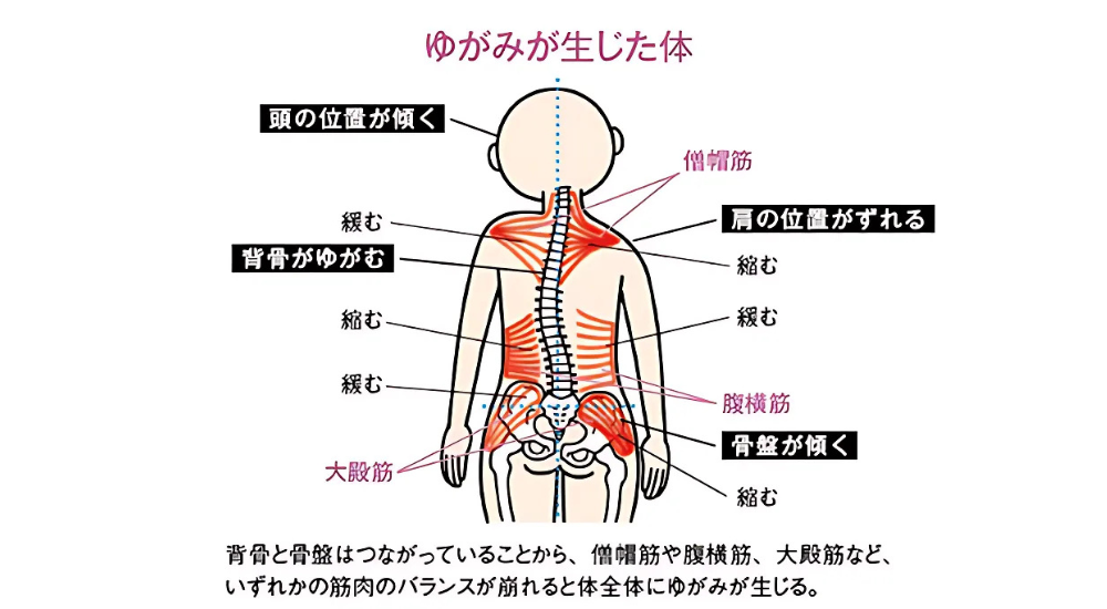 北浦和で肩こりの改善におすすめの整体-北浦和の肩こり専門整体院の頭痛改善におすすめ記事-画像33